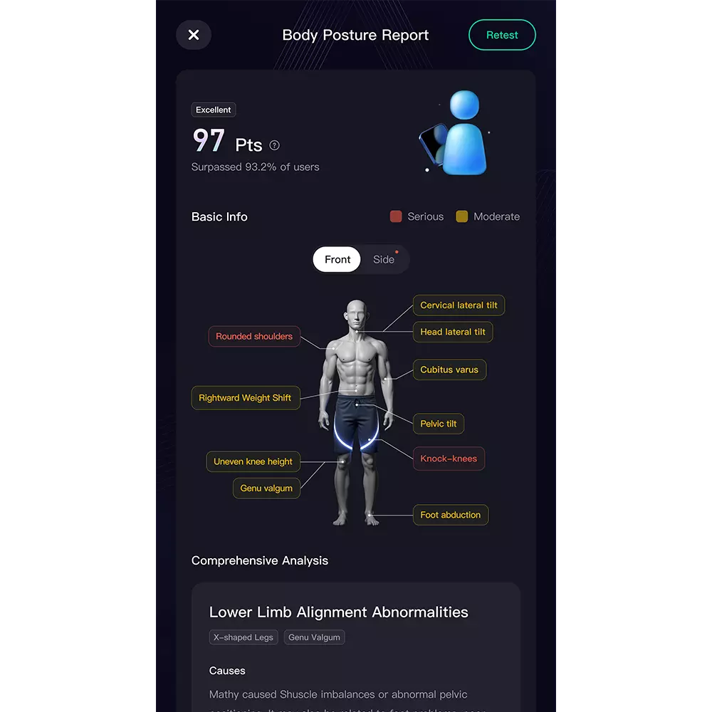 Muscle Strength